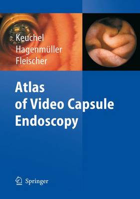 Atlas of Video Capsule Endoscopy - Hagenmaller, Martin, and Hagenma1/4ller, F (Editor), and Keuchel, Martin (Editor)