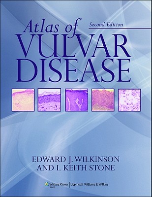 Atlas of Vulvar Disease - Wilkinson, Edward J, MD, and Stone, I Keith