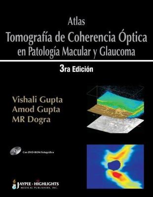 Atlas - Tomografia de Coherencia Optica en Patologia Macular y Glaucoma - Gupta, Vishali, and Gupta, Amod, and Dogra, Mangat Ram