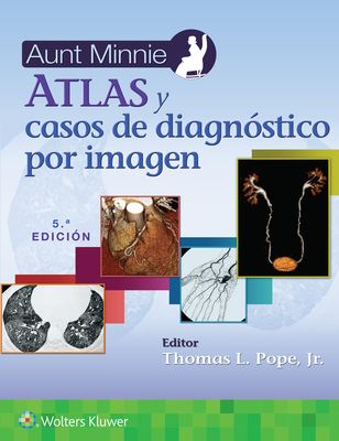 Aunt Minnie. Atlas Y Casos de Diagn?stico Por Imagen - Pope Jr, Thomas L, MD