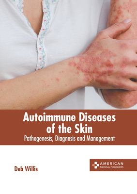 Autoimmune Diseases of the Skin: Pathogenesis, Diagnosis and Management - Willis, Deb (Editor)