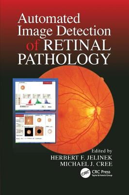 Automated Image Detection of Retinal Pathology - Jelinek, Herbert, and Cree, Michael J.