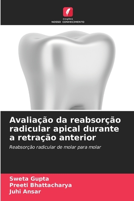 Avalia??o da reabsor??o radicular apical durante a retra??o anterior - Gupta, Sweta, and Bhattacharya, Preeti, and Ansar, Juhi