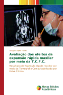 Avalia??o dos efeitos da expans?o rpida maxilar por meio da T.C.F.C.
