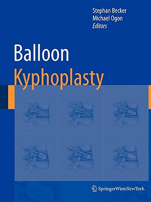 Balloon Kyphoplasty - Becker, Stephan (Editor), and Ogon, Michael (Editor)