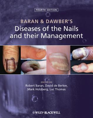 Baran and Dawbers Diseases of the Nails and their Management - Baran, Robert (Editor), and de Berker, David A. R. (Editor), and Holzberg, Mark (Editor)