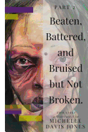 Beaten, Battered, and Bruised, But Not Broken