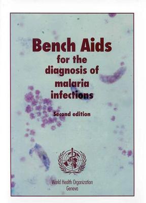 Bench AIDS for the Diagnosis of Malaria Infections - Who