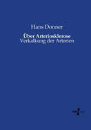 ?ber Arteriosklerose: Verkalkung der Arterien