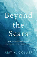 Beyond the Scars: How I Learned God Didn't Abandoned Me in My Darkest Hour