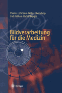 Bildverarbeitung Fur Die Medizin: Grundlagen, Modelle, Methoden, Anwendungen