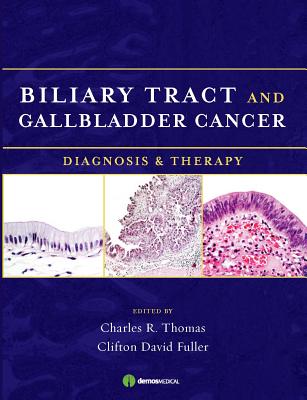 Biliary Tract and Gallbladder Cancer: Diagnosis and Therapy - Thomas, Charles R, MD (Editor), and Fuller, Clifton D, MD (Editor)