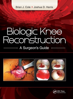 Biologic Knee Reconstruction: A Surgeon's Guide - Cole, Brian, Dr., MD, and Harris, Joshua, MD