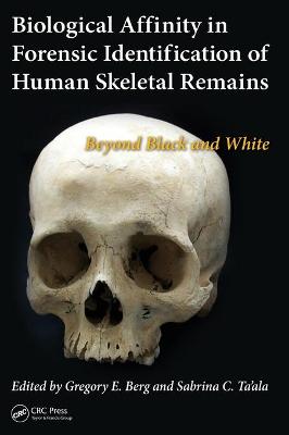 Biological Affinity in Forensic Identification of Human Skeletal Remains: Beyond Black and White - Berg, Gregory E. (Editor), and Ta'ala, Sabrina C (Editor)