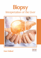 Biopsy: Interpretation of the Liver