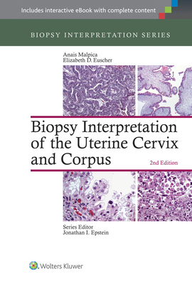 Biopsy Interpretation of the Uterine Cervix and Corpus - Malpica, Anais, MD (Editor), and Euscher, Elizabeth D, MD (Editor)