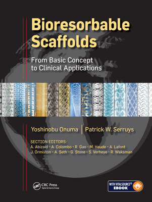Bioresorbable Scaffolds: From Basic Concept to Clinical Applications - Onuma, Yoshinobu (Editor), and Serruys, Patrick W.J.C. (Editor)