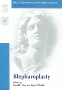 Blepharoplasty - Moy, Ronald L. (Editor), and Fincher, Edgard F. (Editor)