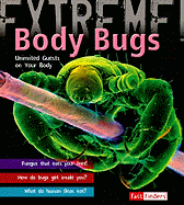 Body Bugs!: Uninvited Guests on Your Body