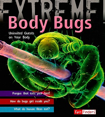 Body Bugs!: Uninvited Guests on Your Body - Capstone Classroom, and Day, Trevor