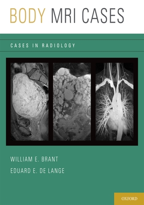 Body MRI Cases - Brant, William E (Editor), and De Lange, Eduard E (Editor)