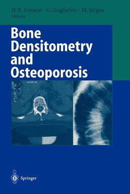 Bone Densitometry and Osteoporosis - Genant, Harry K (Editor), and Guglielmi, Giuseppe (Editor), and Jergas, Michael (Editor)