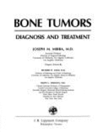 Bone Tumors, Diagnosis and Treatment