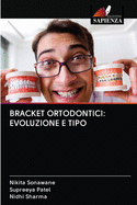 Bracket Ortodontici: Evoluzione E Tipo