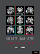 Brain Imaging: A Guide for Clinicians