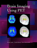 Brain Imaging Using Pet - Kimura, Yuichi (Editor), and Senda, Michio (Editor), and Herscovitch, Peter (Editor)