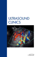 Breast, an Issue of Ultrasound Clinics: Volume 1-4 - Whitman, Gary