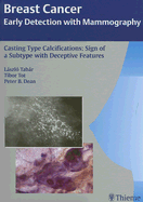 Breast Cancer: Early Detection with Mammography: Casting Type Calcifications: Sign of a Subtype with Deceptive Features