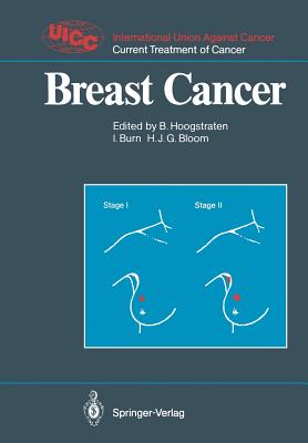 Breast Cancer - Hoogstraten, Barth (Editor), and Bailar, J -C (Contributions by), and Burn, Ian (Editor)