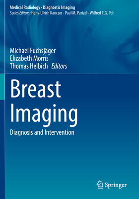 Breast Imaging: Diagnosis and Intervention - Fuchsjger, Michael (Editor), and Morris, Elizabeth (Editor), and Helbich, Thomas (Editor)