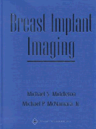 Breast Implant Imaging - Middleton, Michael S, PhD, MD, and Westmeyer, Paul P, and McNamara, Michael P, Jr., MD