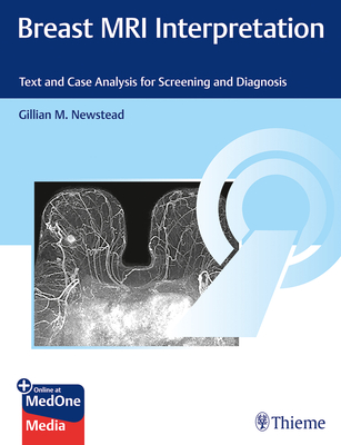 Breast MRI Interpretation: Text and Case Analysis for Screening and Diagnosis - Newstead, Gillian M