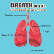 Breath of Life: Understanding Bronchial Asthma