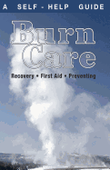Burn Care: Recover, First Aid, Treatment