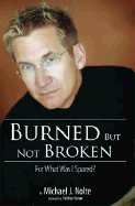 Burned But Not Broken: For What Was I Spared?