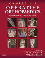 Campbell's Operative Orthopaedics: 4-Volume Set with DVD