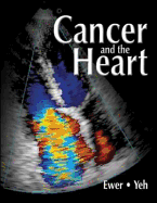 Cancer and the Heart