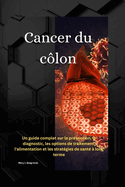 Cancer du clon: Un guide complet sur la prvention, le diagnostic, les options de traitement, l'alimentation et les stratgies de sant  long terme