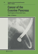 Cancer of the Exocrine Pancreas: From Oncogenes to Unresectable Tumors
