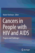 Cancers in People with HIV and AIDS: Progress and Challenges