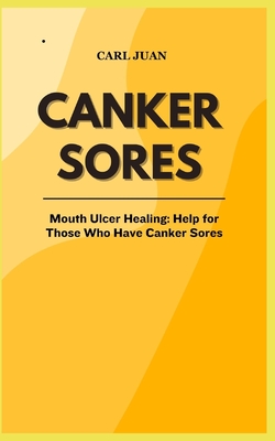 Canker Sores: Mouth Ulcer Healing: Help for Those Who Have Canker Sores - Juan, Carl