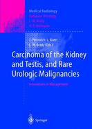 Carcinoma of the Kidney and Testis, and Rare Urologic Malignancies: Innovations in Management