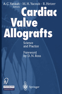 Cardiac Valve Allografts II: Science and Practice