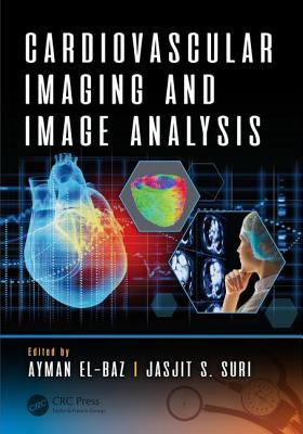 Cardiovascular Imaging and Image Analysis - El-Baz, Ayman (Editor), and Suri, Jasjit S. (Editor)