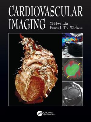 Cardiovascular Imaging - Liu, Yi-Hwa, and Wackers, Frans