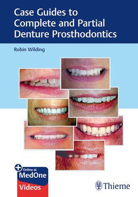 Case Guides to Complete and Partial Denture Prosthodontics - Wilding, Robin